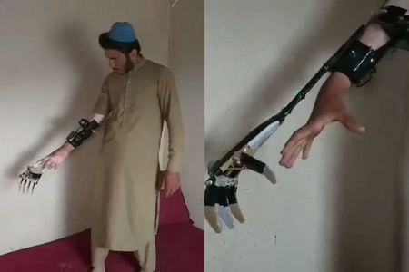 Молодой афганец изобрел роботизированную конечность - ВИДЕО