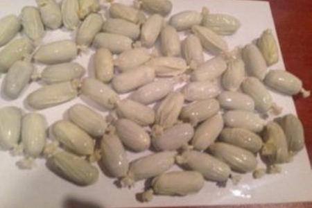 İrandan gələn Azərbaycan vətəndaşının mədəsindən 55 büküm heroin çıxdı - FOTOLAR