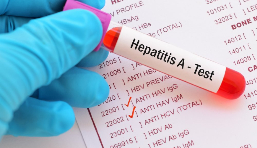 Azərbaycan əhalisinə ÇAĞIRIŞ: hepatit A virusuna qarşı vaksin vurdurun