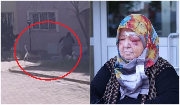 DƏHŞƏT: Sahibsiz itlər 74 yaşlı qadını bu hala saldı - ANBAAN VİDEO
