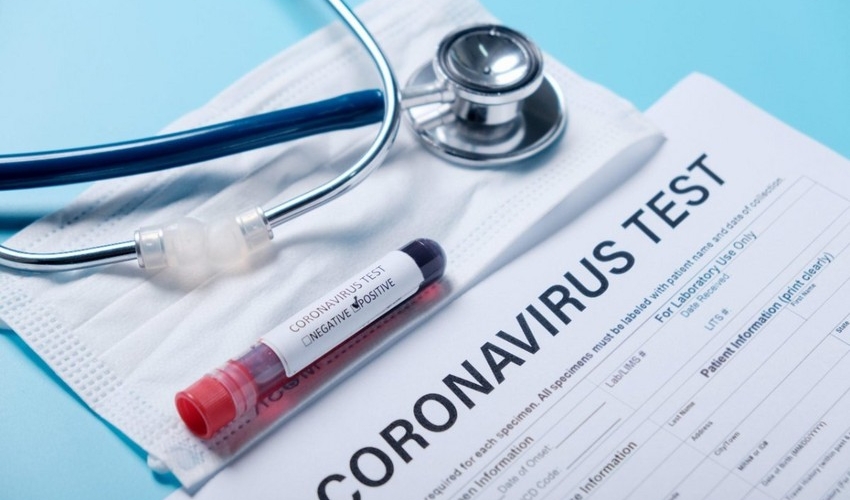 Azərbaycanda 53 nəfər koronavirusa yoluxub, 6 nəfər ölüb