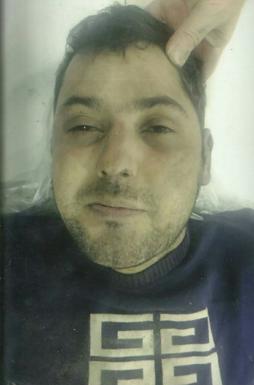 ŞƏKİL - NAMƏLUM MEYİT -S SƏBAİL - 1.jpg (716 KB)