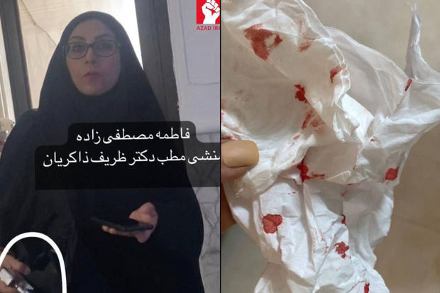 İranda rejim tərəfdarı hicabsız qadına hücum edərək yaralayıb - FOTO