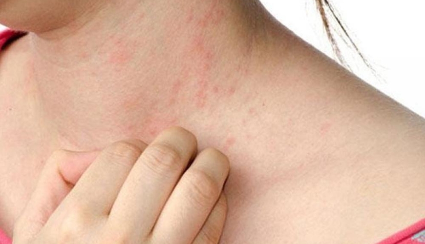 “Allergik xəstəliklərin artmasına səbəb Bakıda əkilən zərərli bitkilərdir” iddiası