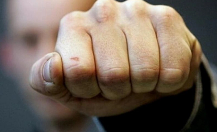 İrəvana gələn polşalı azarkeşlər döyüldülər